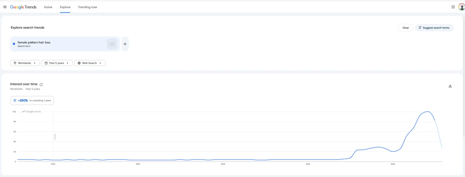 Google Trends chart for female pattern hair loss, worldwide, showing interest up 350 percent; a flat line near zero from 2022 to late 2025, then a rise to a peak in mid-2026