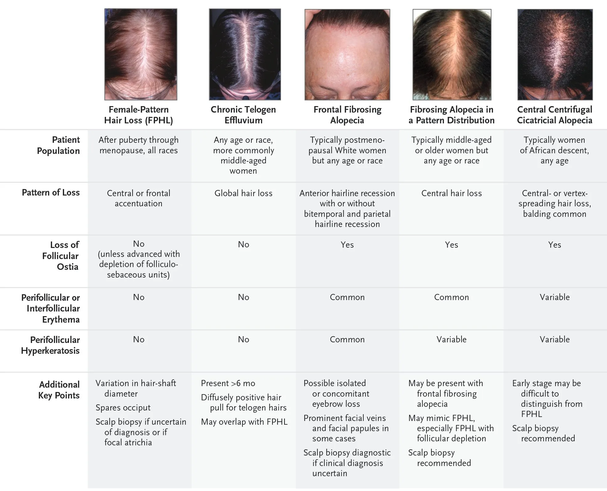 different conditions of fphl-vs-telogen-effluvium-vs-scarring-alopecias