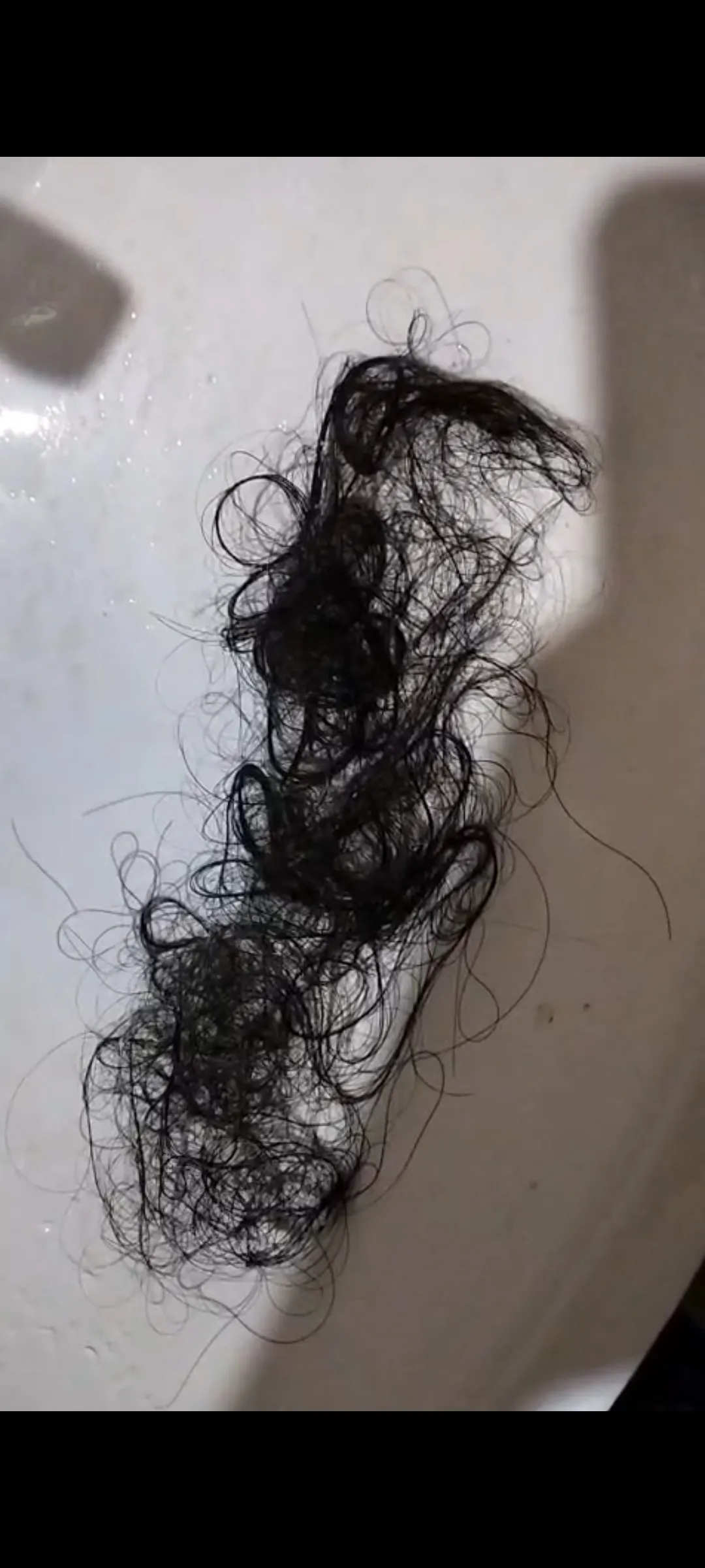 sudden hair shedding in telogen effluvium state