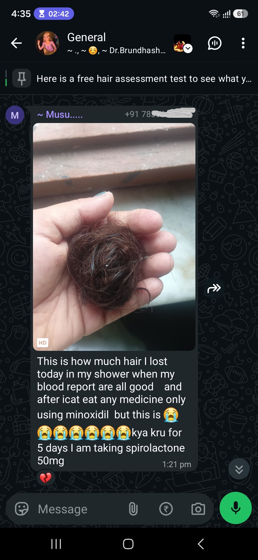 One shower. Her blood work came back normal. She is already using minoxidil, and five days ago she started spironolactone.
