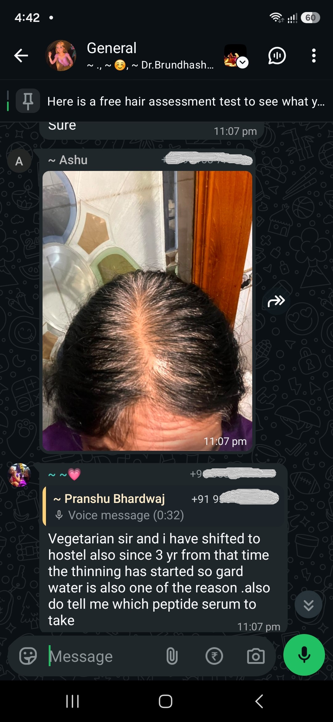 Three years of thinning that began when she moved into a hostel. She suspects the hard water. She is asking which peptide serum to buy.