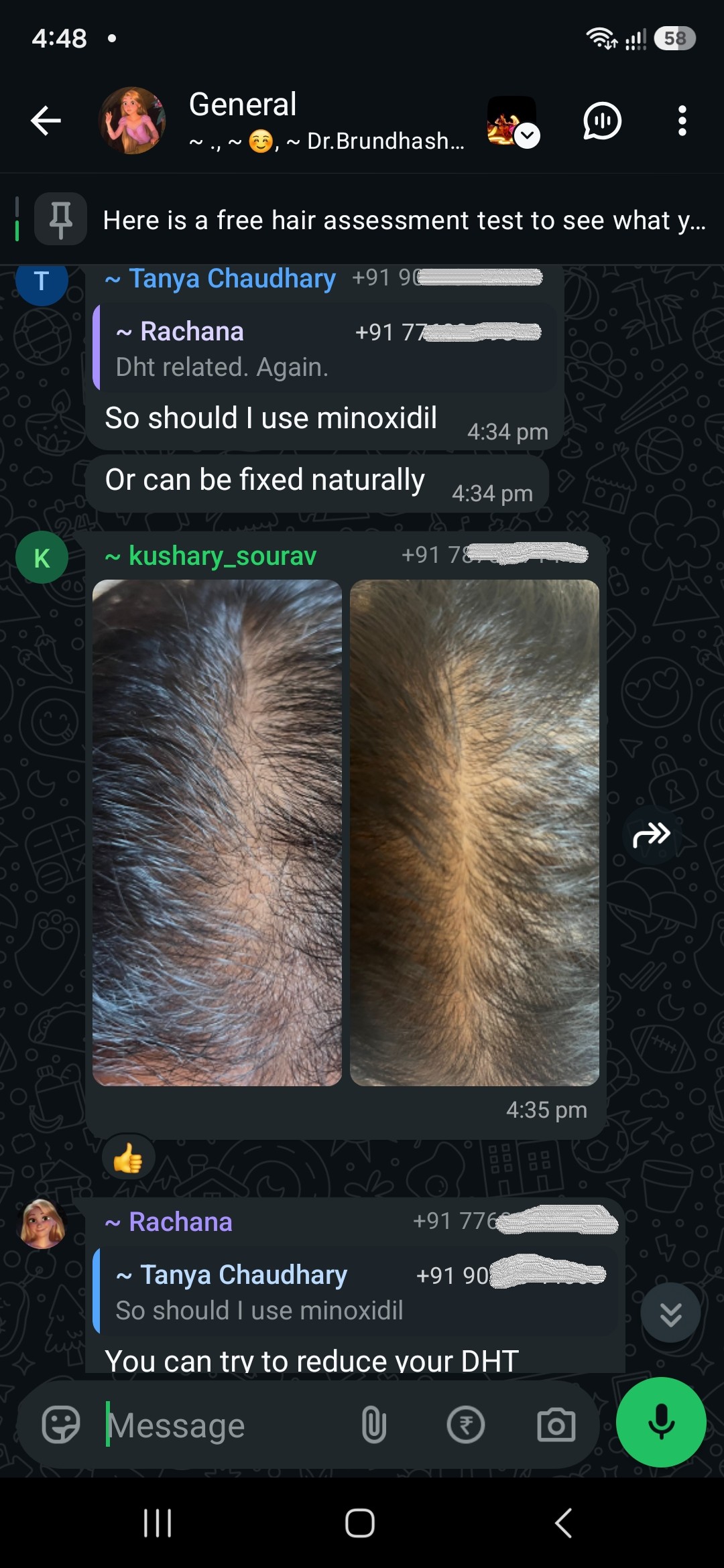 "So should I use minoxidil, or can it be fixed naturally?" That is the question underneath every one of these messages.