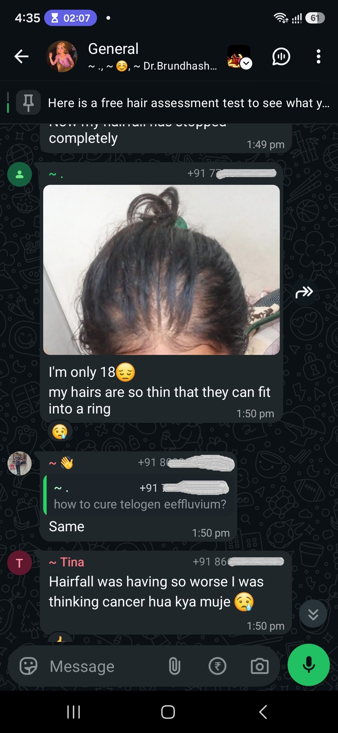 Eighteen years old. "My hairs are so thin that they can fit into a ring." Below her, someone else says the shedding got so bad she wondered if she had cancer.
