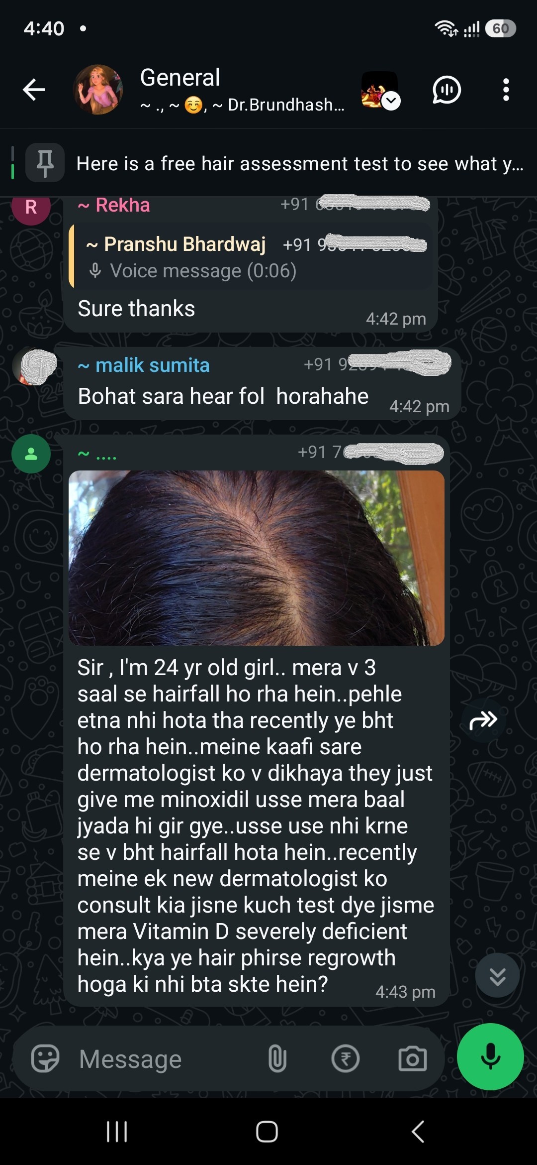 Twenty-four, and shedding for three years. Several dermatologists, and every one of them gave her minoxidil. She says her hair fell faster on it. A new doctor finally ran tests and found she was severely deficient in vitamin D.